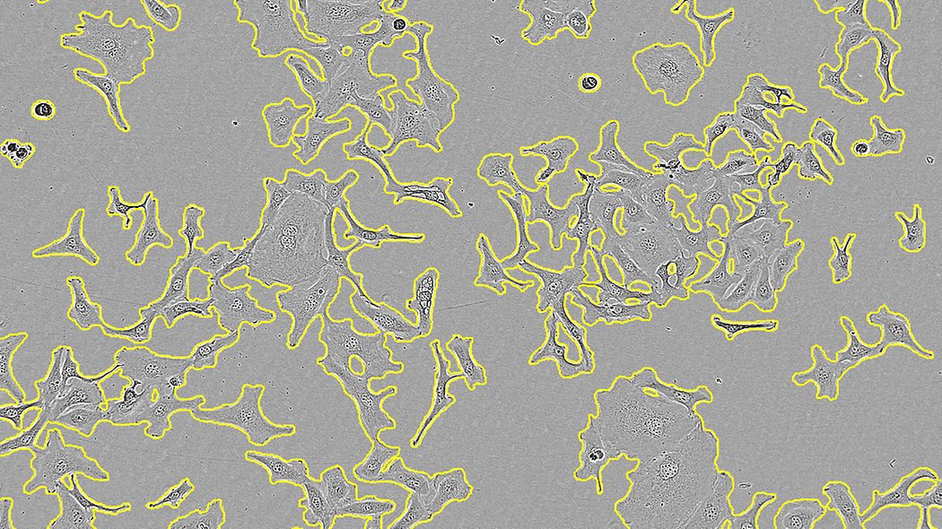 Incucyte® Base basic software module for cell analysis - Sartorius Croatia