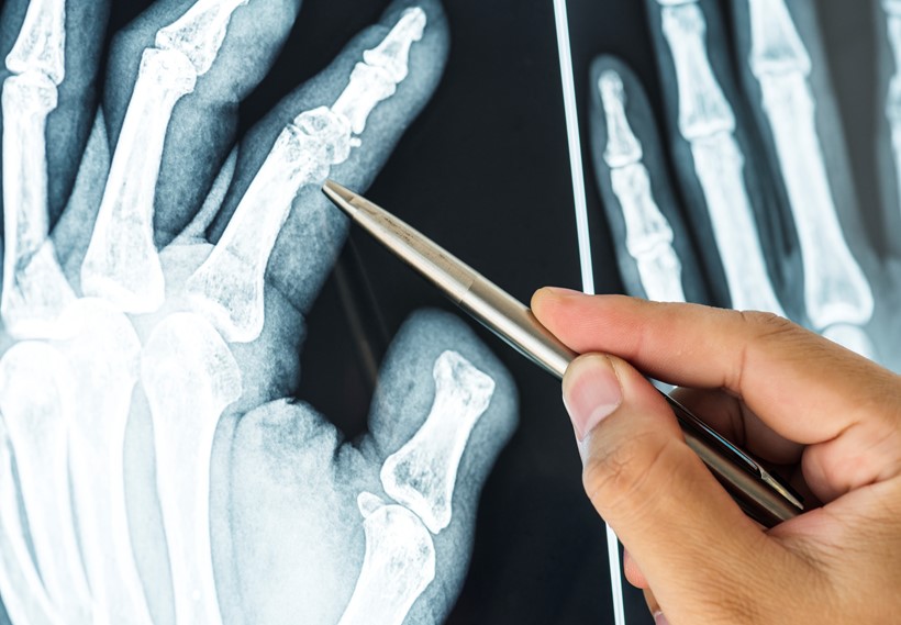 How have we optimized work and minimized the temperature compliance procedures of the Croatian manufacturer of OSTEOGROW cure for bone regeneration? - Sartorius Croatia